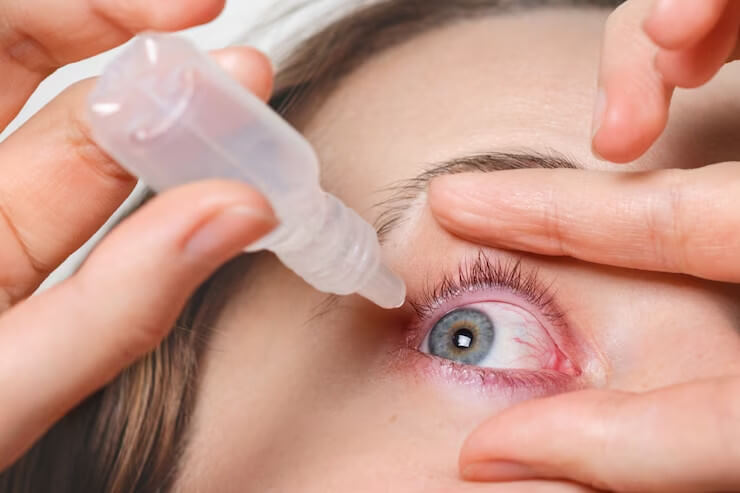 Causes & Treatment for Broken Blood Vessel in Eye